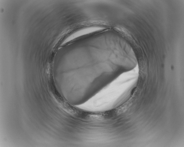 X0000069380167200606021616