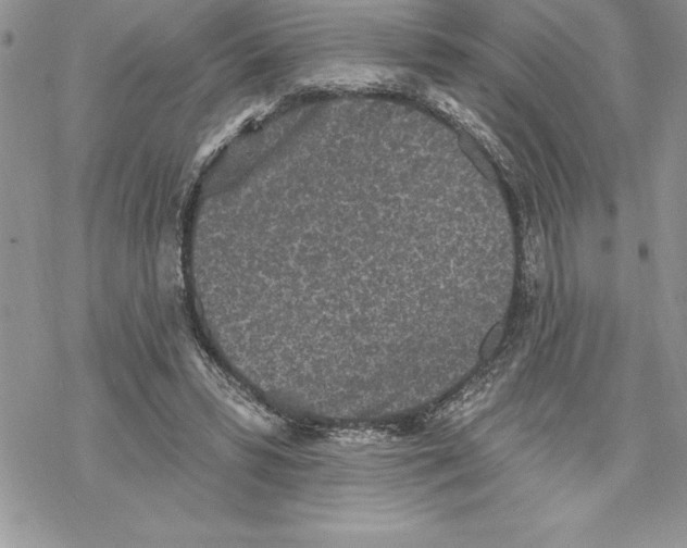 X0000069380399200606021612