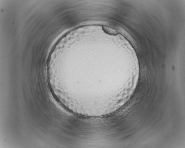 X0000069381092200606021601