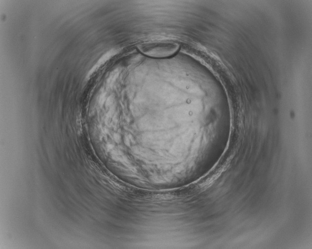 X0000069381306200606021557