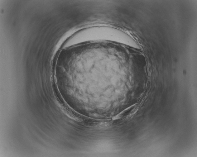 X0000069380056200606091701