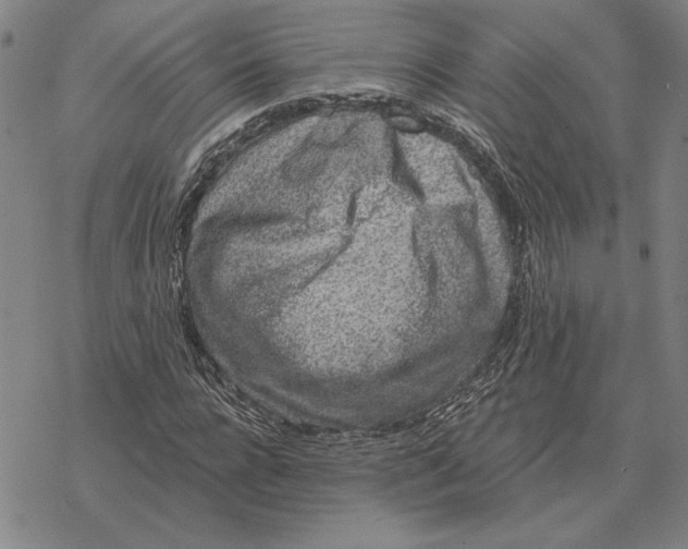 X0000069380920200606091647