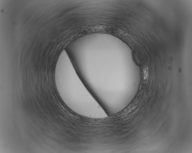 X0000069391011200605120938