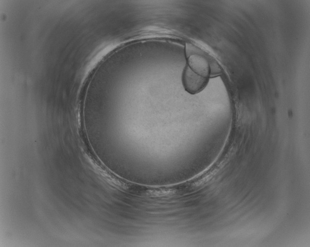 X0000069391415200605121159