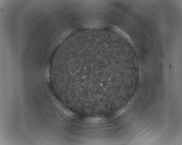 X0000069390065200605150954