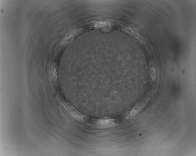 X0000069390375200605150949