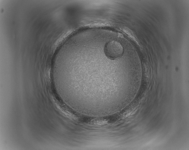 X0000069390491200605150947