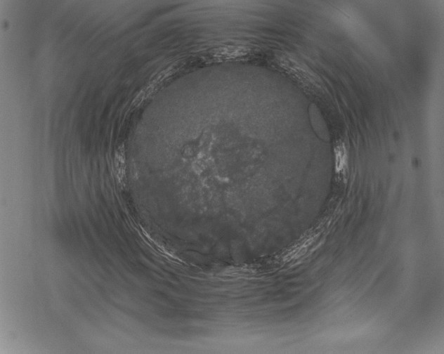 X0000069391011200605150937