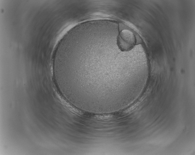 X0000069391415200605150931