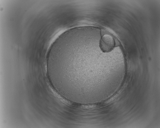 X0000069391415200605192202