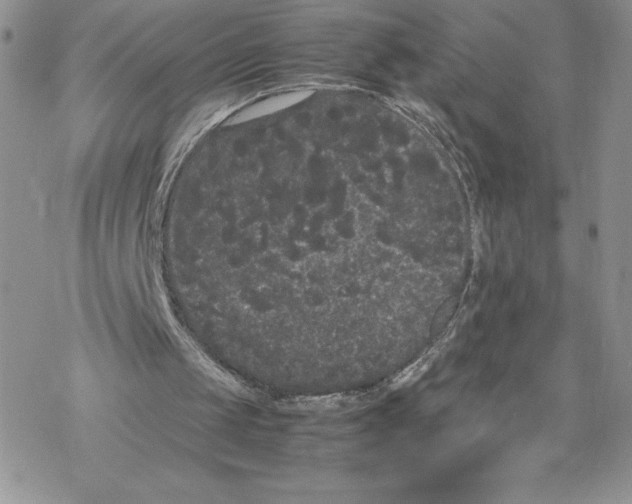 X0000069390049200606021642