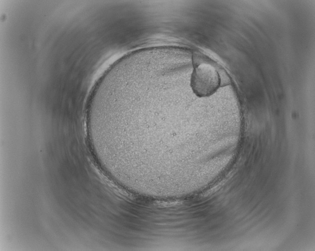 X0000069391415200606021620