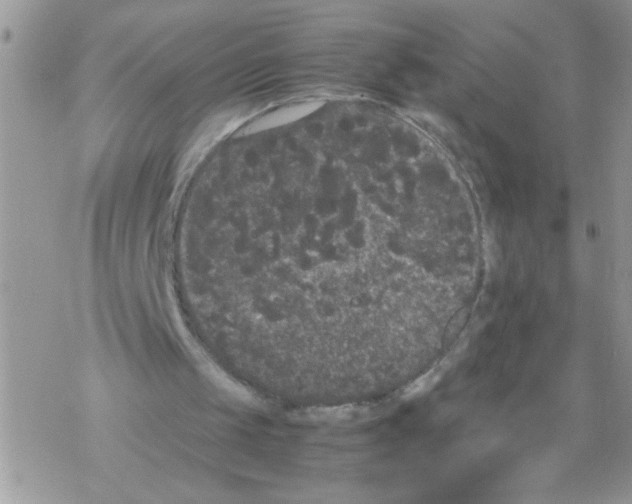 X0000069390049200606091727