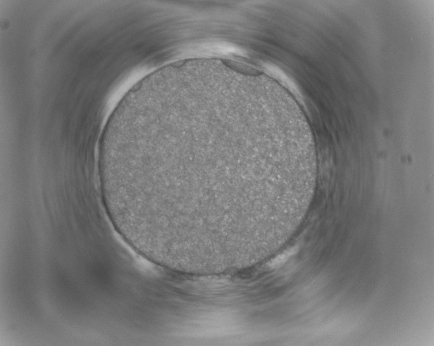 X0000069391103200606091710