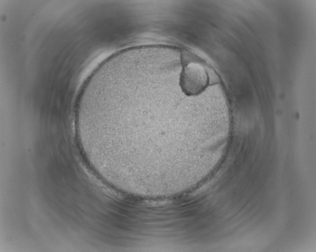 X0000069391415200606091705