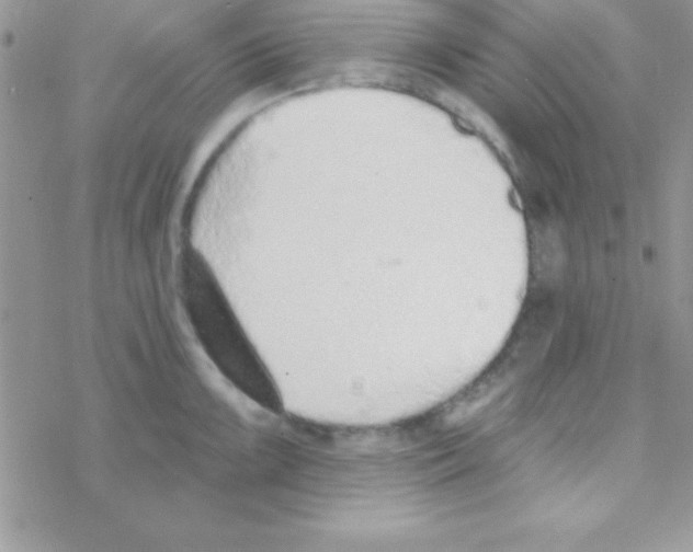 X0000069401099200606091735