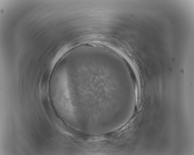 X0000069410099200605192314