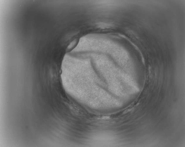 X0000069411158200605262201