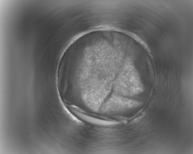 X0000069411239200605262200