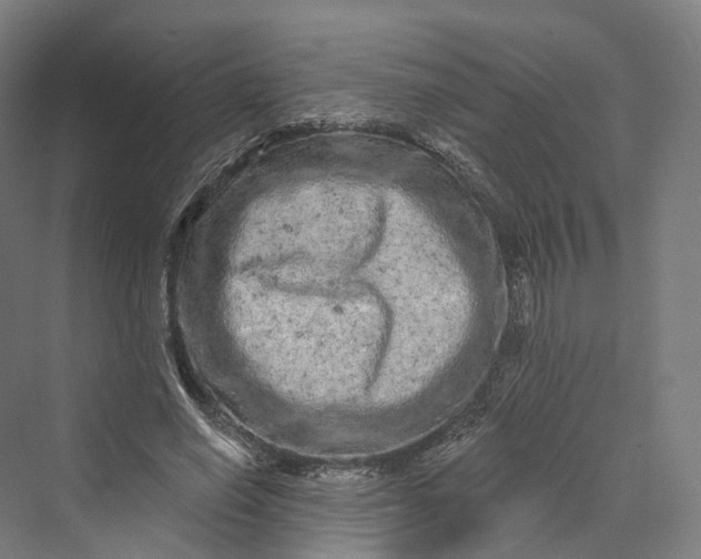 X0000069790638200606021414