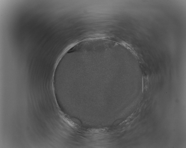 X0000069800147200606021448