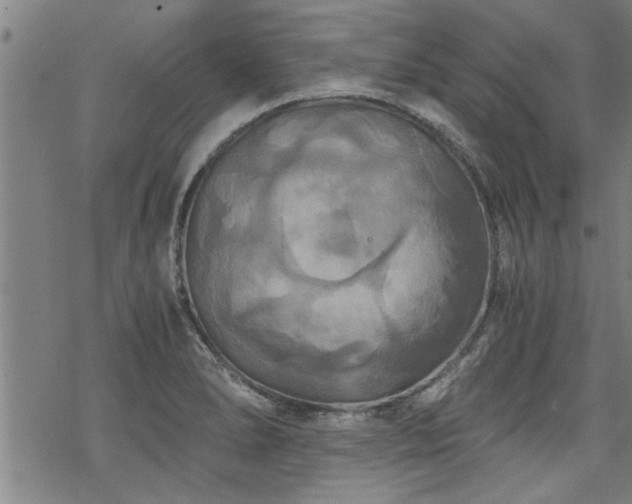 X0000069811278200605191036