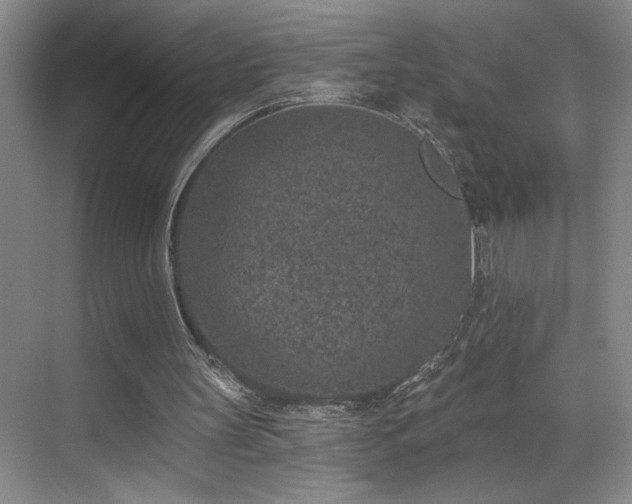 X0000069820147200605221239