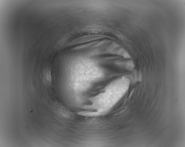 X0000070161155200606162022