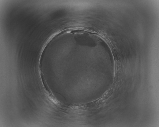 X0000070170147200606021106
