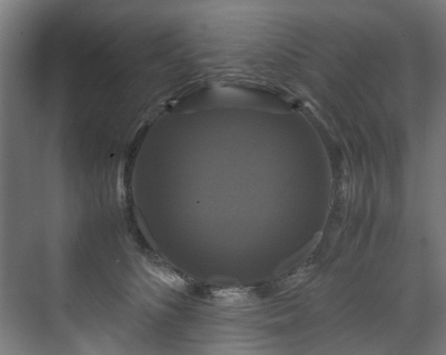 X0000070170516200606021100