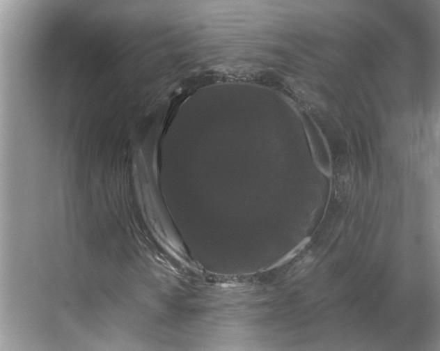 X0000070171010200606091435