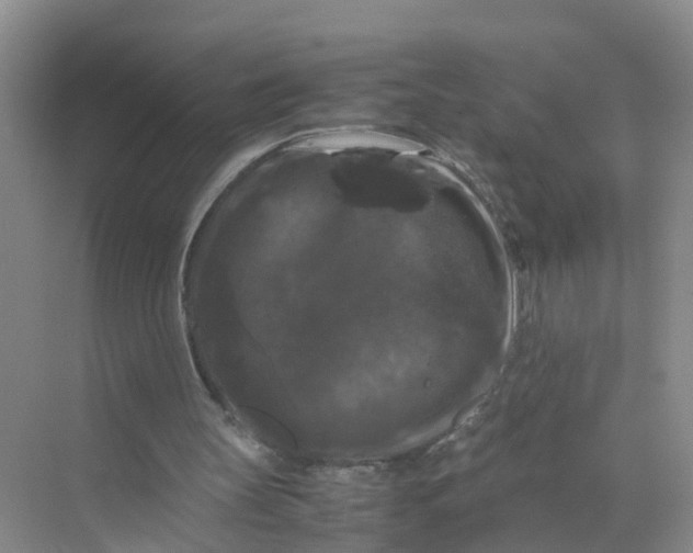 X0000070170147200606162105