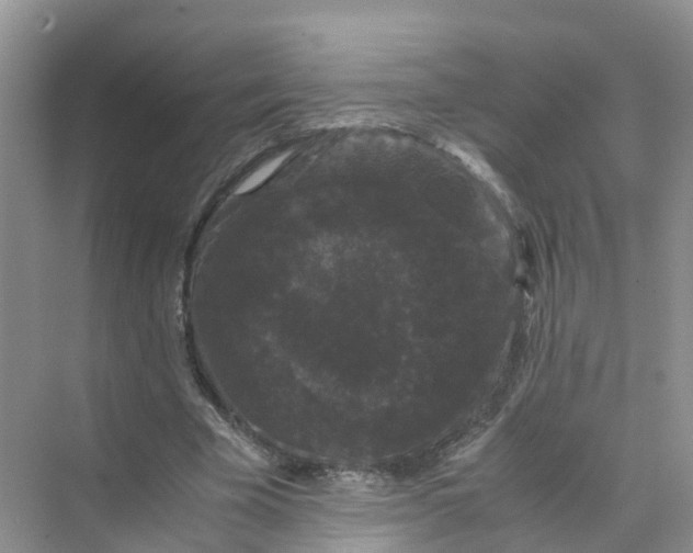 X0000070170585200606162058