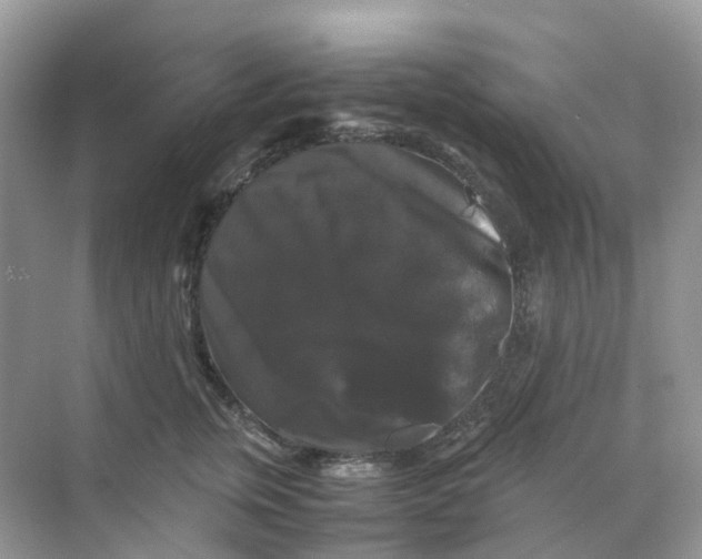 X0000070170759200606162056