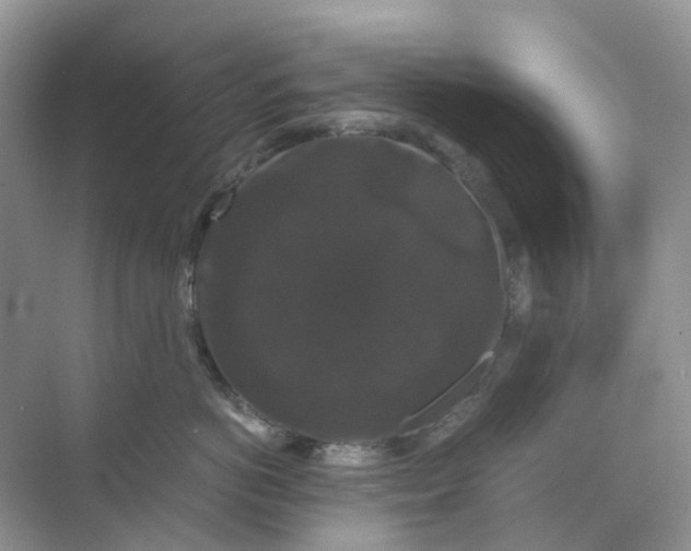 X0000070170766200606162056