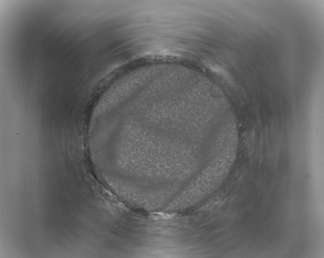 X0000070170870200606162053