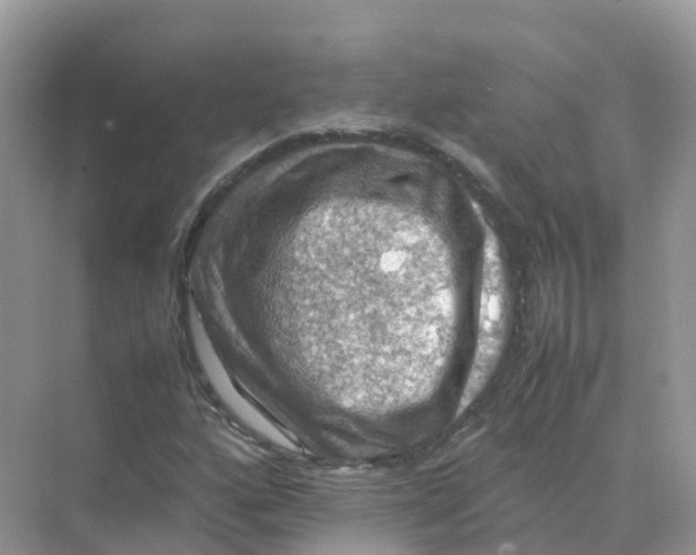 X0000070171160200606162048