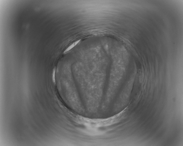 X0000070170047200606231932