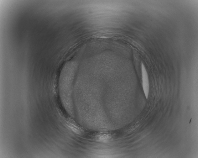 X0000070170604200606231923