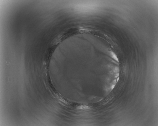 X0000070170759200606231921