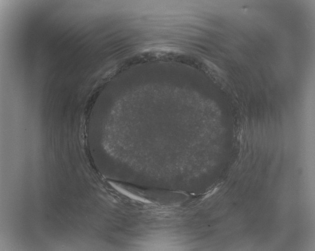 X0000070171014200606231915