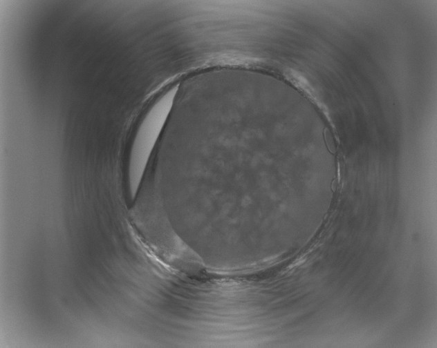 X0000070180249200606091514