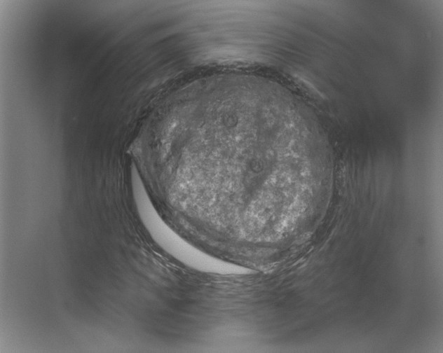 X0000070180917200606091502