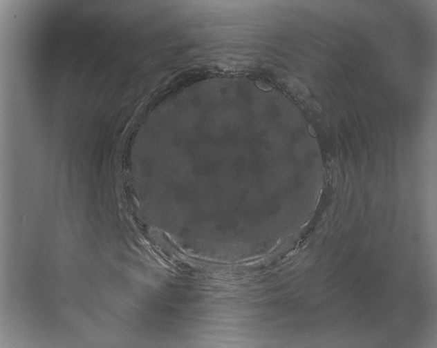 X0000070181009200606091501