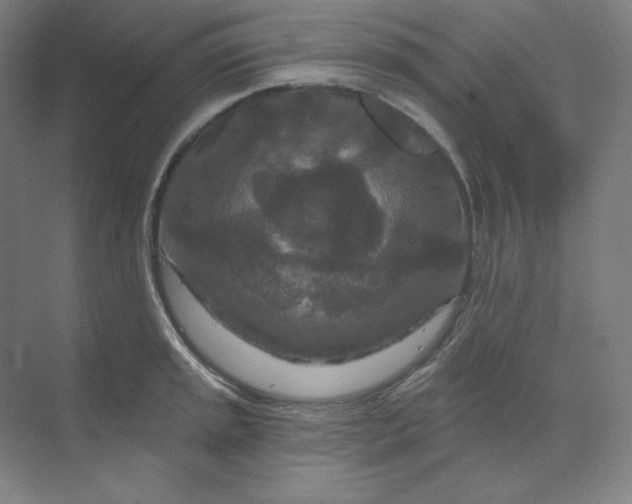 X0000070181045200606091501