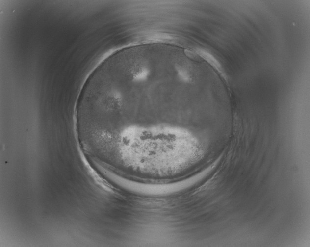 X0000070181047200606091501