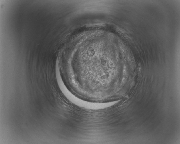 X0000070181059200606091501