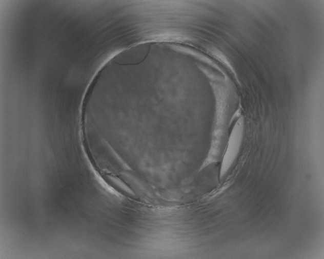 X0000070181087200606091500