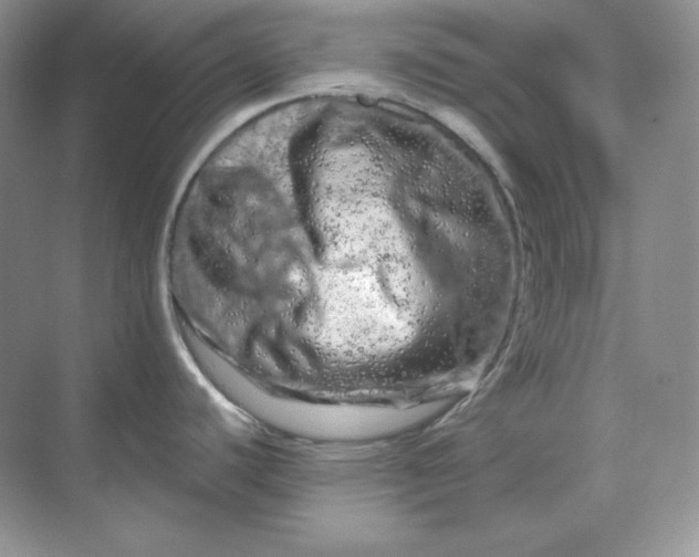 X0000070181440200606091455