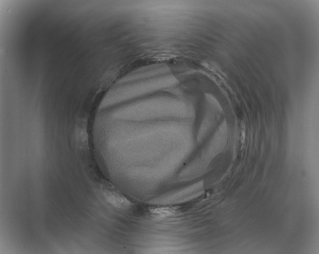 X0000070180516200606162125